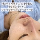 세라케어 | 서면 수분관리 &amp; 물광케어 후기｜세라링으로 정돈된 피부결, 직접 보여드립니다