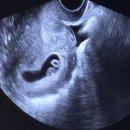 이마트24 R국민건강보험일산병원점 | 국민행복카드 발급 잔액조회 미즈톡톡 임산부 바우처 신청 사용처 삼성카드