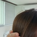 서울대입구 링거펌으로 ★콘헤드 두상 해결한 후기★ 가르마 비침 없앤 모류 교정 대만족