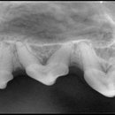 디지레이 이미지