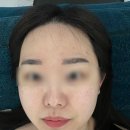 콤마제이헤어 | 울산 피부관리 제이콤마 피부앤 왁싱 후기, 피부관리는 제이콤마에서 !