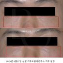 빛나는여성의원 | 송파 판교 피부과 2월 핑크 글로우 이벤트 / 레프톤 힐로웨이브 제네시스토닝 텐쎄라 텐써마 수면리쥬란