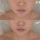 옥현상가 | 무거동 웨딩관리 JW뷰티랩 울산점 윤곽관리 후기 문제성 피부 추천