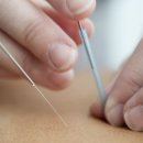 한양신경외과의원 | 때 한의원 한방치료 같이해도 되나요? [서부통신경외과] 대구, 구안와사, 만성통증, 신월성, 서부정류장...