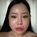 메이필의원 | 강남실리프팅 가격과 실제 후기가 궁금하다면