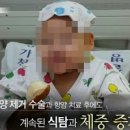 식욕억제 힘든 , 로하드 증후군 이미지