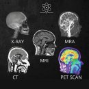 X-Ray, CT,MRI 차이 이미지