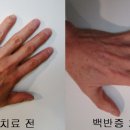 우보한의원 이미지