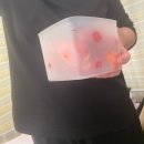 (주)코리트 | [강남성모병원] 자궁내막증 수술후기