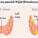 갑상선 기능 항진증과 영양 이미지