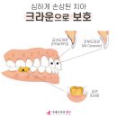재현치과기공소 이미지