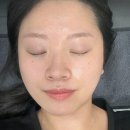 메디아 | (두정동피부관리 추천) 두정동 스킨메디아에서 세멘시트 &amp; 물방울초음파 후기