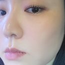 시그노엘 이미지
