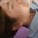 구미 토탈 뷰티샵 뷰티나 플라즈마 두피케어생장술 받고온후기