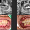 라인아치 치과기공소 이미지