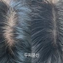 다나두피
