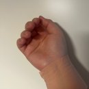 손목 건초염 파스와 이별한 후기