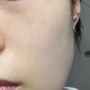 라인포도몰점 | 다이소 바다포도 스킨팩 후기/ 다이소 인기템/ 다이소 품절템/ 내돈내산