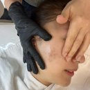 홍대 피부관리 여드름 전문 관리샵 &#39;미더베스트 홍대점&#39; 좁쌀여드름 관리 후기
