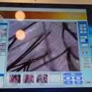 부천 피부관리 상동역 크린브레인, 산후 탈모관리 후기