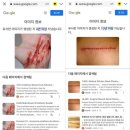 김새론 유가족 김수현 녹취록 공개 김수현 아동복지법위반 고소 부지석 변호사 김수현 공식입장 제보자 피습사진 공개 총정리 이미지