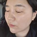 동탄피부관리 여라뷰티 유산균 애플톡테라피 새 생명 불어 넣고 피부장벽세우기