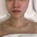 유디존 | [유디톡스] 신부관리 승모근관리 유디톡스 방문 후기