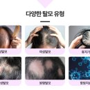 서울시흥초등학교 | 시흥탈모병원, 지금까지 치료 효과가 없었다면 이유는 딱 하나에요