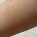 한강수성형외과의원 네이버블로그