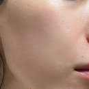 만복약국 | 세비타비겔 여드름 관리에 효과 있을까 사용 후기!