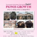 탈모퀸 이미지