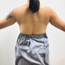 지힐링스퀘어의원 | 지힐링 지방추출주사 팔뚝 지팻주사 시술 당일 후기