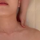 고덕 피부관리 / 뜰에스테틱 고덕점 반쪽 윤곽관리 후기 !🧏🏻‍♀️