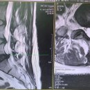 리메디PT 이미지