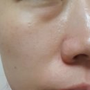 동안피부전문 바이오화장품 새라제나 4D 마스크 체험 후기