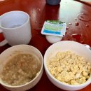 하나이비인후과병원 | 역삼 하나이비인후과 편도절제술 후기 | 입원과 수술 그리고 퇴원