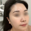 지족로(유성-100) | [대전 유성] 오르네스킨타이트닝 수분관리 후 촉촉광채 피부 완성!