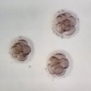 평촌부부한의원 | 난임일기 3화, 평촌마리아 시험관, 배아 이식, 시험관 1차 비용 총정리