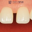 바이오치과기공소 이미지