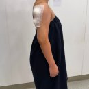 전남제일약국 | 팔뚝 무한람스 상담 및 시술 내돈내산 후기 : 여수에서 서울까지..