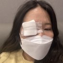 청주퍼스트안과의원 | 15년묵은 콩 다래끼와 작별한 수술후기 청주 퍼스트안과