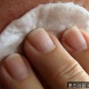 톤즈의원 수원광교점 네이버블로그