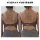 [위례 체형교정] 바디앤포스처에서 체형교정 받은 후기