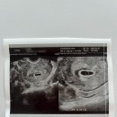 참조은산부인과의원 이미지