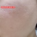 뷰티플 비타민c앰플 히알루론산앰플로 미백&amp; 탄력잡기