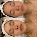 비나인에스테틱 이미지