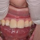 스마트덴치과기공소 이미지