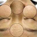 필밸런스의원 | 강남아쿠아필, 놓치면 후회하는 ‘이것’