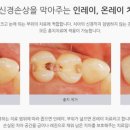 삼성연세고운미소치과의원 네이버블로그