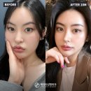 제이티성형외과의원 이미지